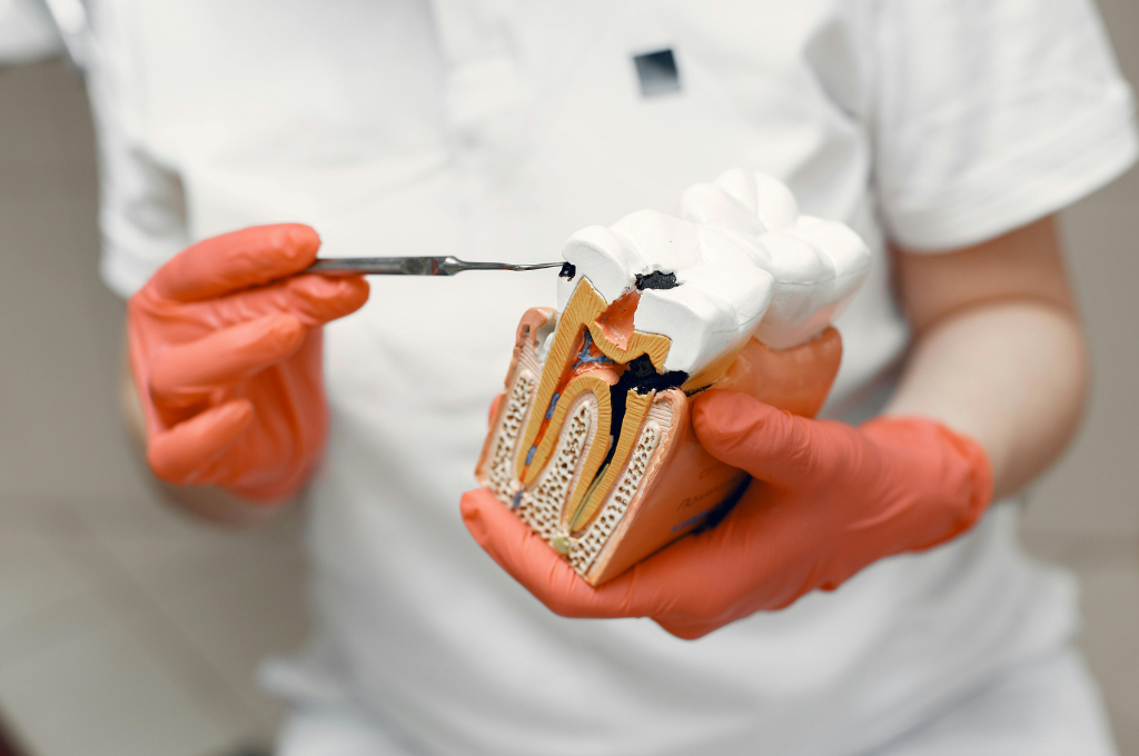 Educational dental model used to explain treatment options and family dentistry services
