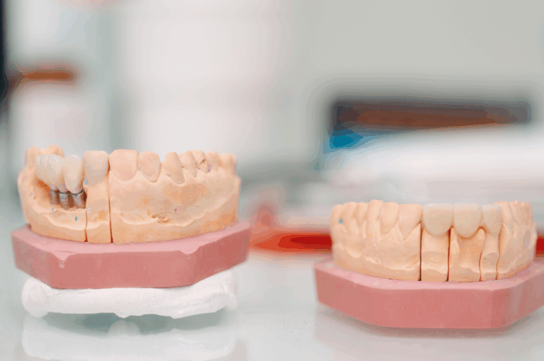Understanding your dental options