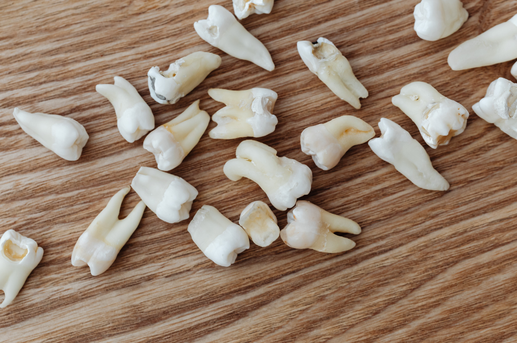 Mitigating tooth loss, tooth loss, reducing the risk of tooth loss